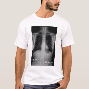 “Retro VHS X-Ray” Old-school chest X-ray with VHS T-Shirt