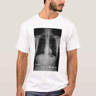 “Retro VHS X-Ray” Old-school chest X-ray with VHS  T-Shirt