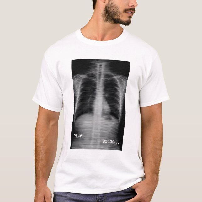 “Retro VHS X-Ray” Old-school chest X-ray with VHS  T-Shirt (Front)