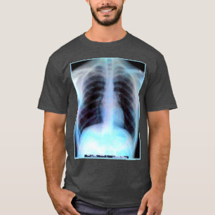 Ribcage X-ray Shirt