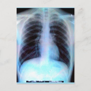 Ribcage Xray Skeleton Postcard by Crosier at Zazzle