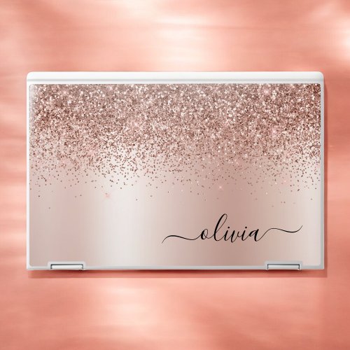 Rose Gold _ Blush Pink Glitter Metal Monogram Name HP Laptop Skin