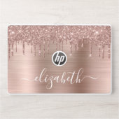 Rose Gold Dripping Glitter Personalized HP Laptop Skin (Front)