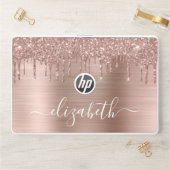 Rose Gold Dripping Glitter Personalized HP Laptop Skin (Desk)
