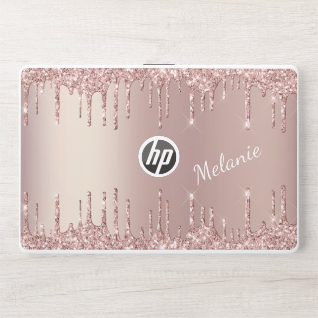 Rose Gold Glitter Custom Name HP Laptop Skin Gift (Front)