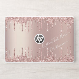 Rose Gold Glitter Custom Text HP Laptop Skin