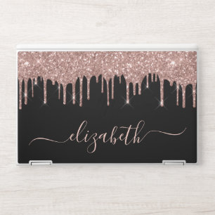 Rose Gold Glitter Drips Black HP Laptop Skin