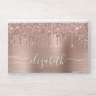 Rose Gold Glitter Drips Personalized HP Laptop Skin