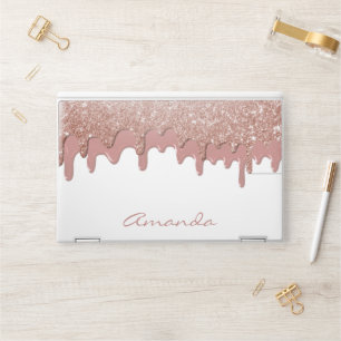 Rose Gold Glitter Drips Personalized HP Laptop Skin