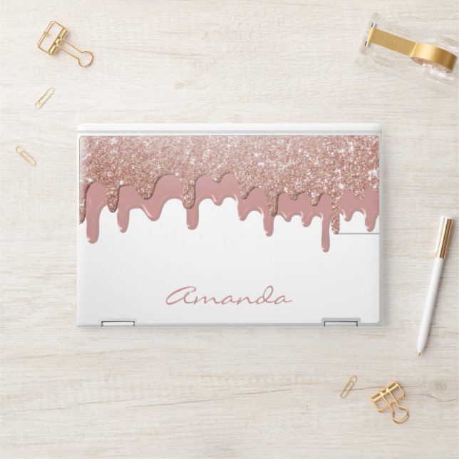 Rose Gold Glitter Drips Personalized HP Laptop Skin (Desk)