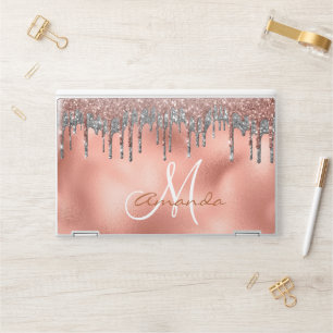 Rose Gold Glitter Drips Personalized Monogram HP Laptop Skin
