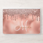 Rose Gold Glitter Drips Personalized Monogram