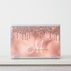 Rose Gold Glitter Drips Personalized Monogram