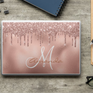 Rose Gold Glitter Drips Personalized Monogram HP Laptop Skin