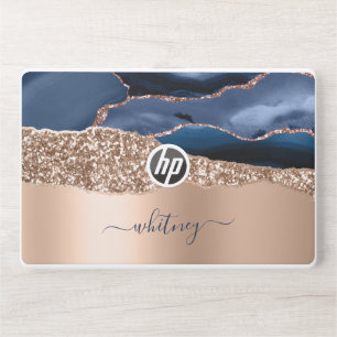 Rose Gold Glitter Elegant Monogrammed Navy Blue HP Laptop Skin