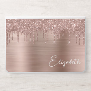 Rose Gold Glitter HP Laptop Skin