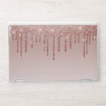 Rose Gold Glitter Liquid Drips HP Laptop Skin