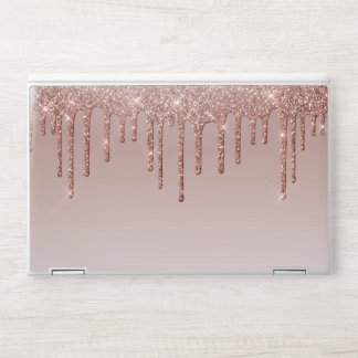 Rose Gold Glitter Liquid Drips HP Laptop Skin