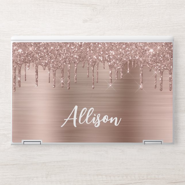 Rose Gold Glitter Monogram Name HP Laptop Skin (Front)