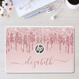 Rose Gold Pink Dripping Glitter Personalized HP Laptop Skin