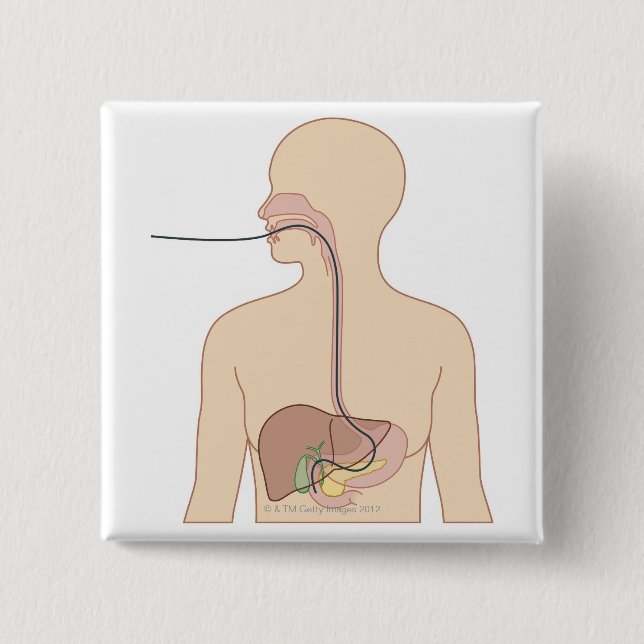 Route of Endoscope Button (Front)