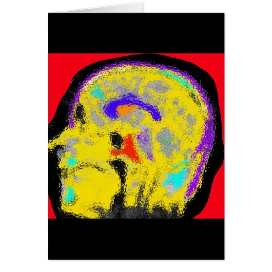 sagital MRI Cards (Front)
