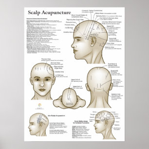 Scalp Head Acupuncture Points Poster