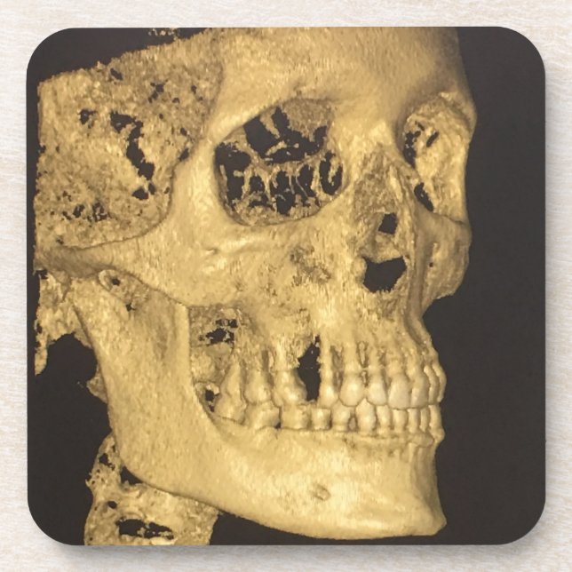 Scary Skull Beverage Coaster (Front)