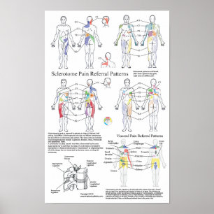Sclerotome Visceral Pain Referral Chart