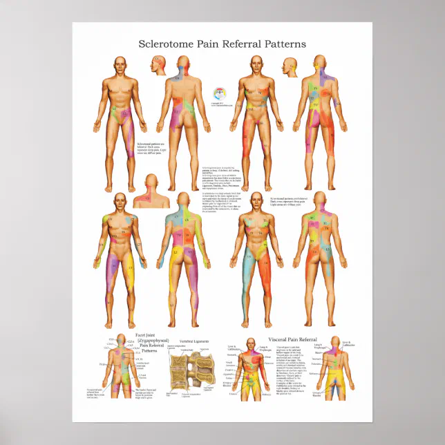 Sclerotome Visceral Pain Referral Poster | Zazzle