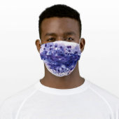 Secretory Carcinoma, Parotid Face Mask (Worn)