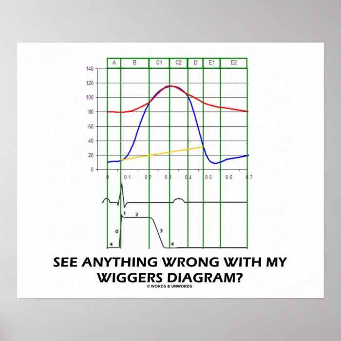 See Anything Wrong With My Wiggers Diagram? Print