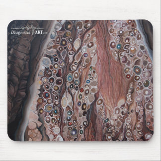 "Sensation: Dorsal Root Ganglion" Mouse Pad