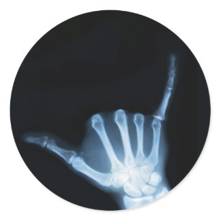Shaka Sign X-Ray (Hang Loose) Classic Round Sticker