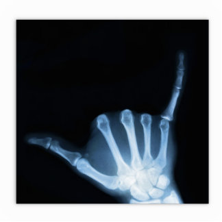 Shaka Sign X-Ray (Hang Loose) Statuette