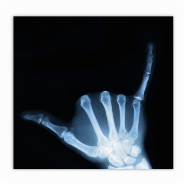 Shaka Sign X-Ray (Hang Loose) Statuette (Front)