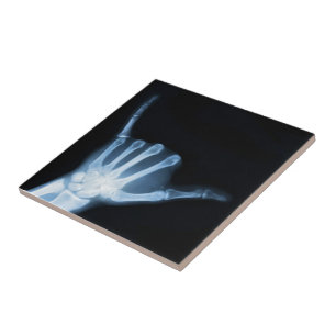 Shaka Sign X-Ray (Hang Loose) Tile