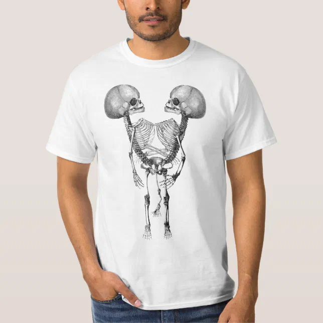 Siamese conjoined Twins Anatomy Skeletons art T-Shirt | Zazzle