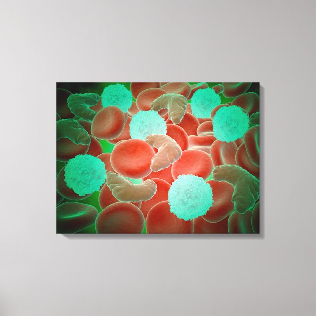 Sickle Cell Anemia With Red Blood Cells Canvas Print (Front)
