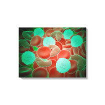 Sickle Cell Anemia With Red Blood Cells Canvas Print