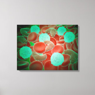 Sickle Cell Anemia With Red Blood Cells Canvas Print