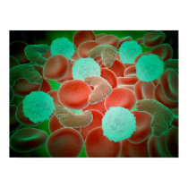 Sickle Cell Anemia With Red Blood Cells Poster