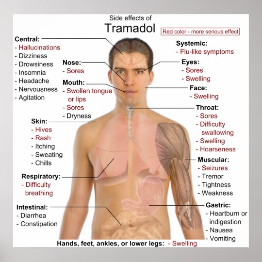 Tramadol Side Effects Agitation