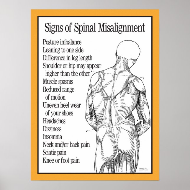 Signs of Spinal Misalignment Poster (Front)