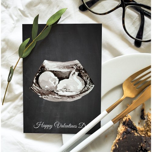 Simple Baby Is Coming Happy Valentines Day Gift Holiday Card