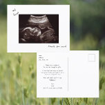 Simple Funny Ultrasound Baby Shower Thank You Postcard<br><div class="desc">Simple Funny Ultrasound Photo Baby Shower Thank You Postcard.  Baby's Perspective.  Thank You from the Baby.</div>