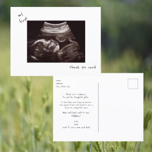 Simple Funny Ultrasound Baby Shower Thank You Postcard