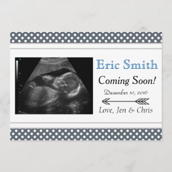 Simple Unisex Ultrasound Baby Announcement by FridaBarlowDesign at Zazzle