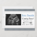 Simple Unisex Ultrasound Baby Announcement at Zazzle