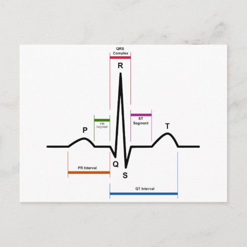 Sinus Rhythm in an Electrocardiogram ECG Diagram Postcard